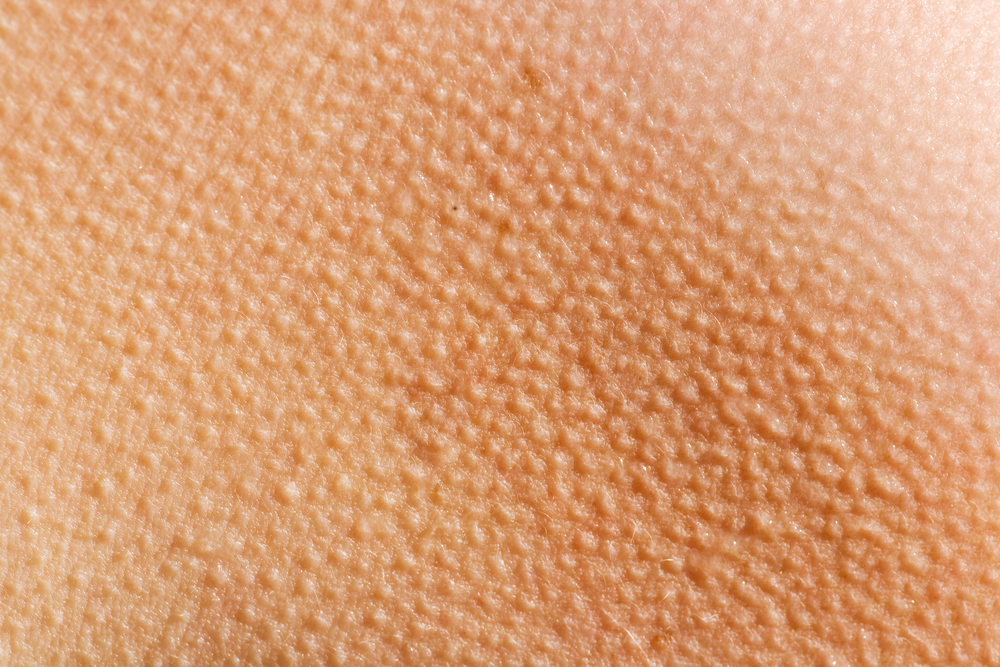 All you need to know about goosebumps