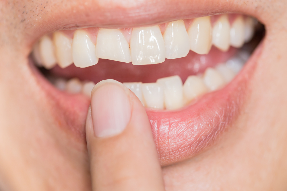 The secret author of your life story, your teeth